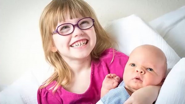 A Baby Boy Was Born With An Abnormally Long Head Then The Doctor Gave His Family Terrifying News