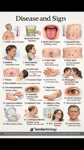 diseases and sign
