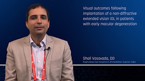 Alcon Science: Brazil | Eyetube