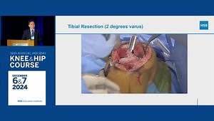 Caliper Based Kinematic Alignment: No Robot Required