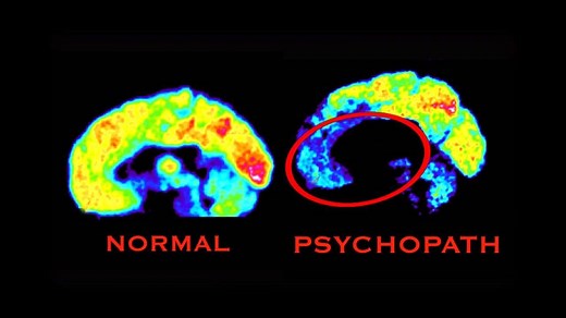 39K views · 244 reactions | Do psychopathic killers have different...