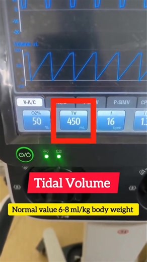 2.1K views · 69 reactions | Basics of Ventilators for All Medical professionals Ventilators is a medical devices that support or replace breathing by delivering oxygen and removing carbon dioxide, used in critical care, post-surgery, and for respiratory disorders. They come in invasive and non-invasive types with adjustable settings like tidal volume, respiratory rate, and oxygen concentration. Nursing Officer  | Nursing Officer | Facebook