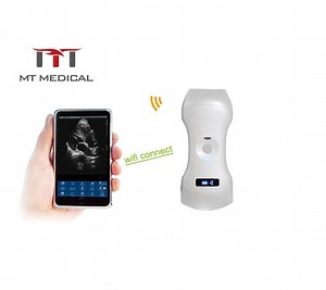 [Hot Item] Medical Equipment 3 in 1 Wireless Ultrasound Scanner WiFi Probe