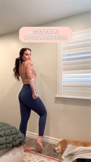 emma | certified weight loss coach on Instagram: "These are all real comments l’ve gotten on my loose skin. “Lift weights.” “You lost weight too fast.” “Use this cream.” “Fasting will fix it.” “You’re young, it’ll go away.” I’ve heard it all. I did everything “right.” Calorie deficit. Weight training. High protein. Slow, steady, consistent. I still have loose skin. Because for most people, it’s just genetics. It’s normal. It’s a part of extreme weight loss that nobody talks about enough. I didn’