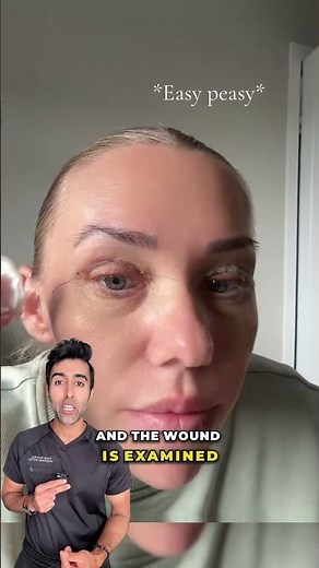 Is It Safe To Take Out Stitches By Yourself?