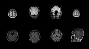 Multisection Result Of Mri Human Brain Stock Footage SBV-349086680 - Storyblocks