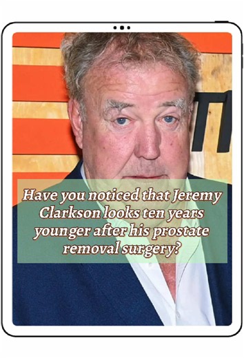 Jeremy Clarkson Appears Younger After Prostate Surgery — 3 Surprising Reasons