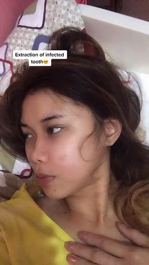 Tooth Extraction Recovery Timeline and Dental Journey