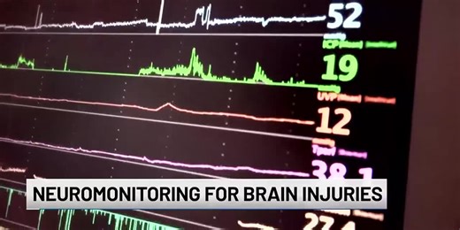 Tracking TBI: Neuromonitoring for brain injuries