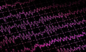 ¿Qué es el ruido rosa y por qué se llama así?