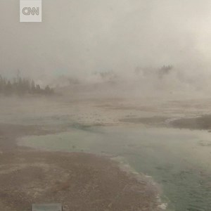 178K views · 649 reactions | A 21-year-old man suffered severe burns...