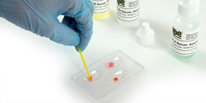 Students Explore Blood Type Chemistry | Science Buddies Blog