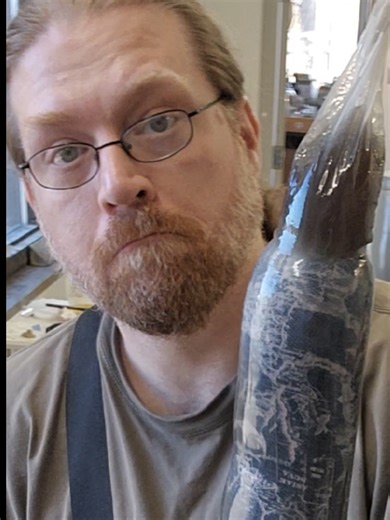 Creating Pediatric Prosthetics with Laminated Layers