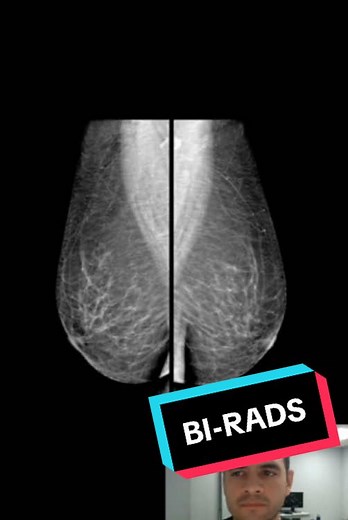 ¿Qué es el BI-RADS?