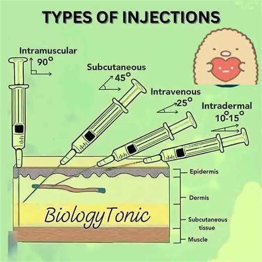 types of injections #anatomy#injection#siteof injection