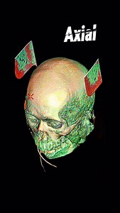 MSCT-Axial Coronal Sagittal ✅‼️ #ctscan #Radiology | Sobat Radiology