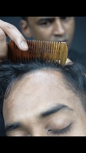 59K views · 716 reactions | Satisfying Dandruff Removal #reelsvideo #satisfying #dandruffremoval | Home ASMR clinic | Facebook