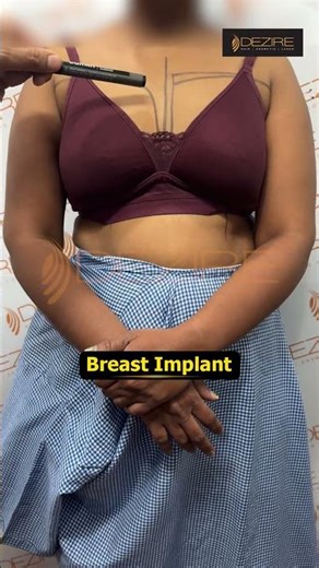 Breast Implant Marking