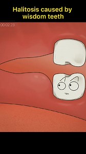 6.9M views · 10K reactions | #sciencefacts #mathematics#physics#life #subject #science #quantumphysics Please pay attention to your wisdom teeth. #wisdomteeth #cause #halitosis #foryou #fypシ | Sience | Facebook