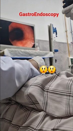 Camera Going Inside Stomach Through Oesophagus 😲 | Endoscopy View