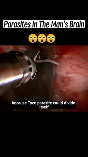 Flyingfrog on TikTok