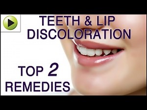 Teeth & Lip Discoloration - Natural Ayurvedic Home Remedies