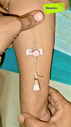 Pink Cannula 💗 | Pink IV Cannula Insertion | Nursing Skills #shorts