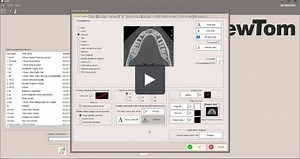 NNT 11 - Graphic Options