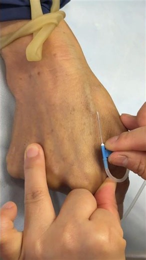 Injection Technique Made Simple | Types of Needle Injections You Need To Know 93