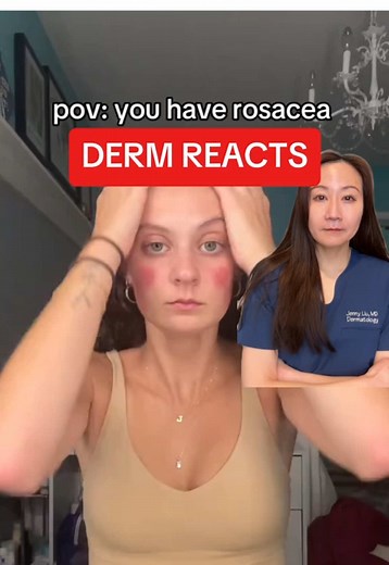 Calming Cleansers for Rosacea and Sensitive Skin