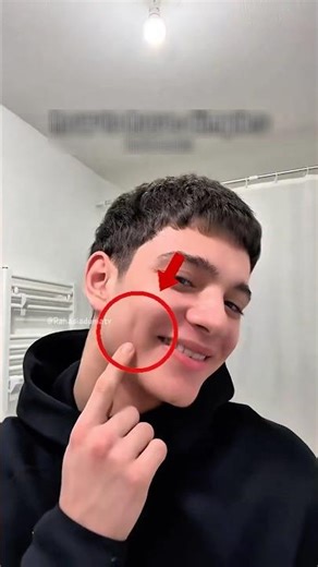 Fakta Medis di Balik Lesung Pipi