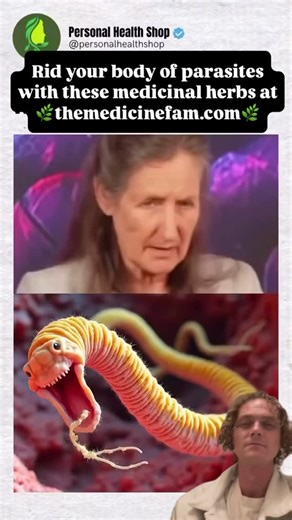 An excess of parasites in the body can lead to many different types...