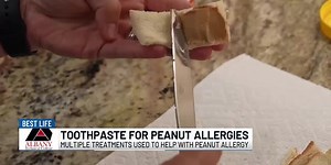 Toothpaste for Peanut Allergies!