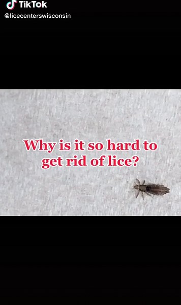 Getting rid of lice is as easy as 1 5 5! #licelessons #licecenterswi #licetreatment #lice #licefree #fyp #foryou #foryoupage