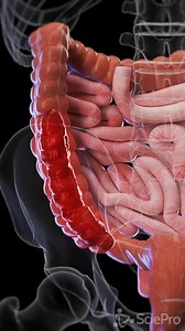 🌿 Understanding Constipation: A Common Digestive Issue 🌿 Dive into the causes and effects of constipation, a prevalent condition that affects people of all ages. Learn about the factors that contribute to slowed bowel movements and the impact it can have on everyday wellness. Our detailed visuals and expert insights help demystify this common condition. Stay informed and take steps towards maintaining a healthy digestive system. #DigestiveHealth #ConstipationAwareness #Wellness #SciePro #scien