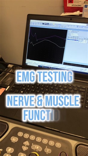 💥 EMG TEST 💥 🔌Electromyography (EMG) is a diagnostic modality designed to assess the interaction between the muscles and nerve function! 💢 What conditions can an EMG test diagnose? 🔸 Carpal tunnel syndrome 🔸 Pinched nerve 🔸 Muscle disorders 🔸 Myasthenia gravis 🔸 AND MANY MORE! 🤝 At Alliance Orthopedics, we strive to get you BETTER EVERDAY! Call 📲 201-808-3155 today!#fyp #foryou #allianceorthopedics #bebettereveryday #orthopedics #orthopediccare #modalities