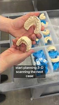 Come With Us and See How Reset Smile Dentures Are Made!!✨