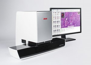 Escaner de Laminas Motic Modelo EasyScan, Opciones de 1, 6, 60 y 102 laminas - Gene X-Press