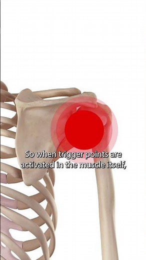 Teres Minor Trigger Points