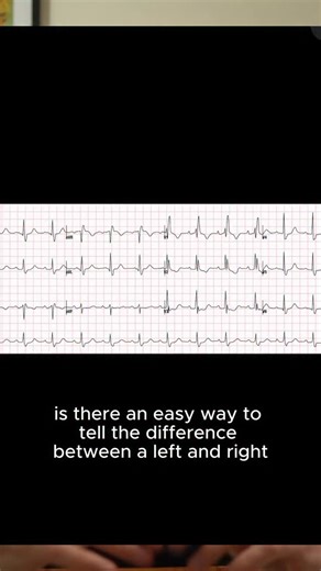 LBBB vs RBBB 🚑 | Pocket Paramedic