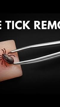 Tick Remover Tool: Essential for Safe and Effective Tick Removal