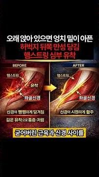 [강성통증] 허벅지 뒤쪽 만성 당김? | 스트레칭이 아니라 '햄스트링 심부 유착'부터 풀어야 합니다 👑 #햄스트링 #허벅지통증 #좌골신경통 #허벅지당김 #엉덩이통증 #다리저림
