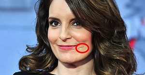 The Terrifying Story Behind Tina Fey’s Scar