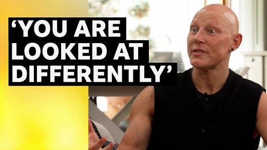 Heather Fisher on alopecia, identity & resilience