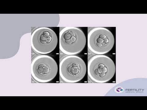 Incubadora Embryoscope®Plus