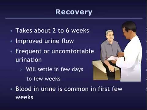 Transurethral Resection of the Prostate (TURP)
