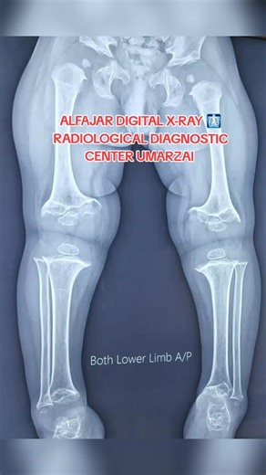 #viralvideo #foryoupage❤️❤️ #tiktokteamviralvideos🙏🙏 #tiktokteamunfreezmyacount😥🙏 #everyone