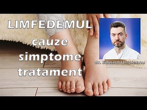Limfedemul - Cauze, simptomele si tratament | Institutul Venelor
