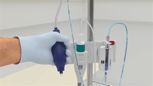 FloTrac sensor setup血流动力学