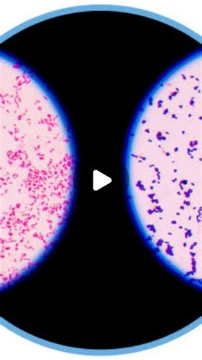 Baybars ŞAHİN on Instagram: "▪︎Gram-staining (Gram boyama): 📍Gram boyama, bakteri türlerini iki büyük gruba ayırmak için kullanılan bir boyama yöntemidir: gram-pozitif bakteriler ve gram-negatif bakteriler. Mantar enfeksiyonunu teşhis etmek için de kullanılabilir. Bu isim, tekniği 1884 yılında geliştiren Danimarkalı bakteriyolog Hans Christian Gram'dan gelmektedir. 📍Gram boyama, bakterileri hücre duvarlarının kimyasal ve fiziksel özelliklerine göre ayırt eder. Gram-pozitif hücrelerin hücre duv